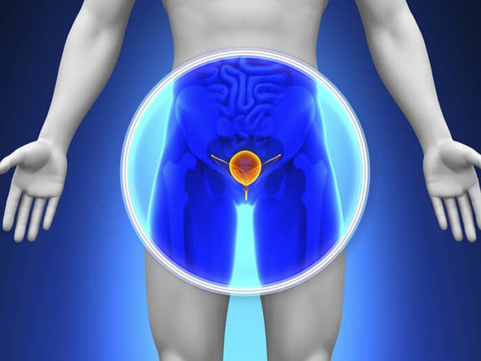O Que é e Quais são os Sintomas do Câncer de Próstata