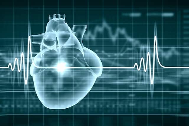 Check-up Cardiovascular: Saiba quando fazer